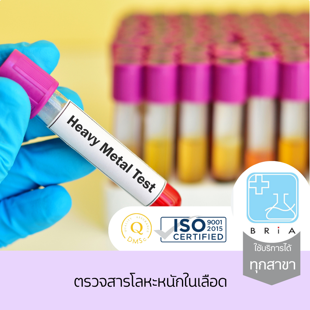 ตรวจสารโลหะหนักในเลือด